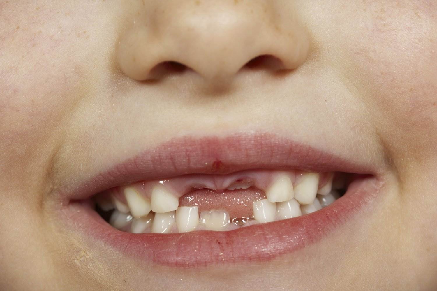 Dental care free of charge for all children from 1 January - mynd